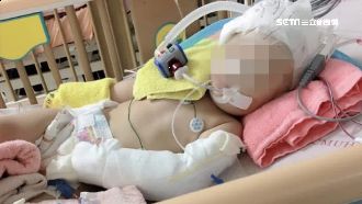 遭虐女童今拔管？　醫院：非家屬決定
