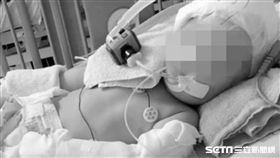 台中太平1歲女童疑遭保母虐待