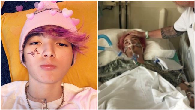 昏迷14天…18歲男星驚爆死訊