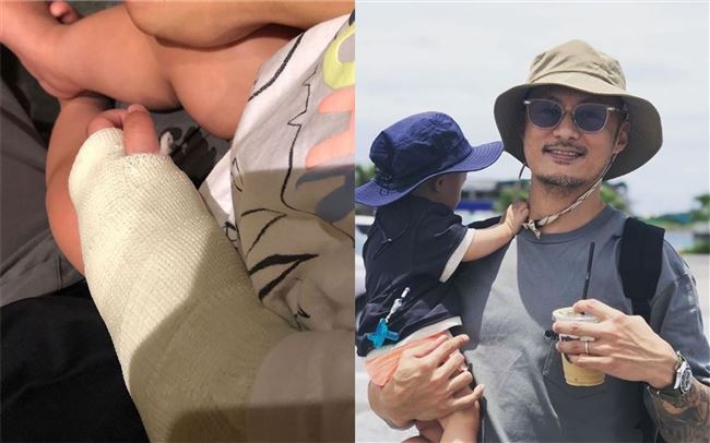 余文樂1歲兒受傷了！小手纏滿厚紗布