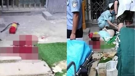 婦遭滅火器砸頭爆腦漿　兇是10歲鄰