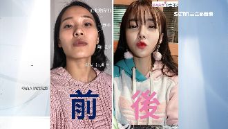 小模赴韓整型　回台差很大過不了海關