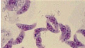 剛地弓形蟲。(圖/翻攝自百度百科)