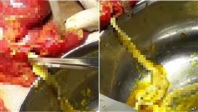 豬肉,印度,胃痛,生食,絛蟲 (圖／翻攝自YOUTUBE Daily Mail
)