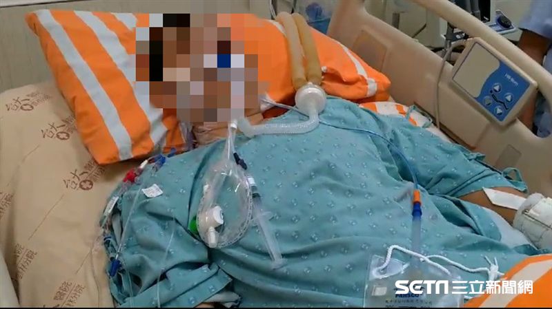 勇警追捕嫌犯遭撞重傷　她盼加強裝備