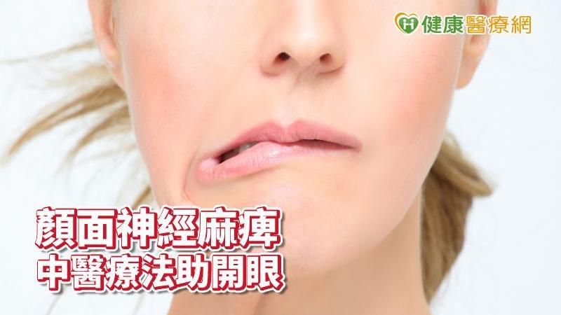 顏面神經麻痺眼睜不開　針灸助婦開眼