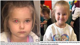 沒預兆！4歲女兒拍照左眼驚見白點　醫檢查竟是罕見癌症（圖／翻攝自每日郵報）