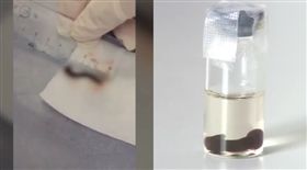 喉嚨明顯異物感「有東西在動」　婦女咳血就診…3公分水蛭緊貼氣管（圖／梨視頻）