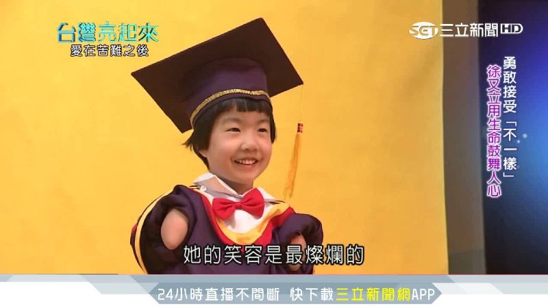 單腳天使克服缺陷　勇敢接受不一樣