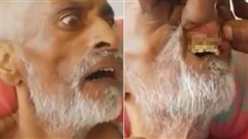 中風父嘴唇發腫…掀開內擠滿「蠕動白蛆」！兒傻眼崩潰了
allAfrica.com twitter