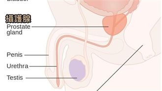 攝護腺癌教我們的事 趕走它有6大招