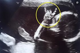 胎教聽流行天王的歌！寶寶照超音波「嗨比Rock」打招呼（圖／翻攝自Kennedy News and Media twitter）