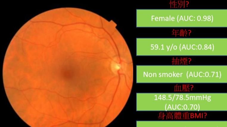 這張照片　可以看出性別、年齡、血壓