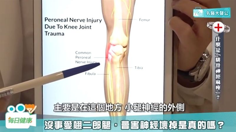 翹腳壞習慣　小心神經麻痺！