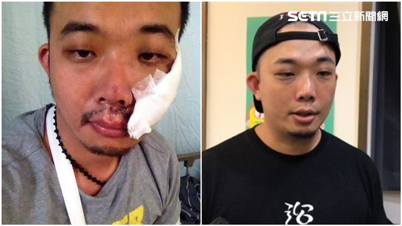 PO傷照引熱議！廣德家老闆回應了