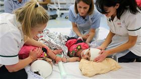 巴基斯坦,連頭嬰,姊妹,分割,醫療,手術,英國（圖／翻攝自大奧蒙德街兒童醫院網頁）