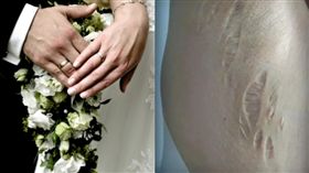 醫師娘新婚2個月「皮膚突潰爛崩裂」…夫一句話露恐怖馬腳(圖/微博,PIXABAY)