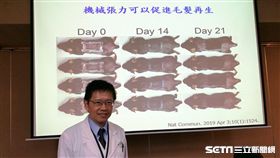 台北榮總皮膚部研究團隊今（17）日發表新研究成果發現，利用皮膚拉撐裝置施予小鼠適當的皮膚張力，可誘發毛髮再生。（圖／記者楊晴雯攝）