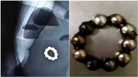  小小一顆磁力珠，號稱可以訓練幼童的腦部發展，不少家長買來給孩子作為益智遊戲使用，但其實磁力珠也有許多潛在風險，經常造成兒童誤吞導致胃穿孔、發炎，甚至還有人因此不幸喪命。大陸山東這名1歲男童也發生了誤吞磁力珠的情況，他的家人表示因為他不停出現腹痛、嘔吐的症狀，因此才趕快帶他就醫，不料醫生在照完X光之後，發現男童胃部居然出現一串「手環」，這時家人才驚覺這串珠子可能是家中的磁力珠！（圖／翻攝自梨視頻