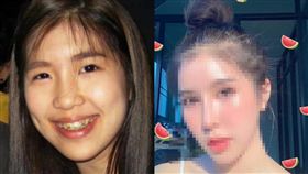 整型,塑膠臉,網紅,手術　圖／翻攝臉書