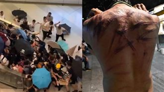 白衣人血洗元朗　釀36傷1命危