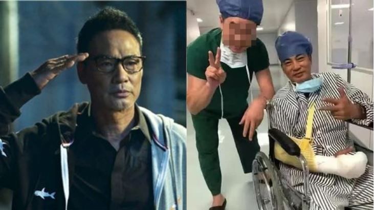 4指神經被割斷…任達華傷口照曝光