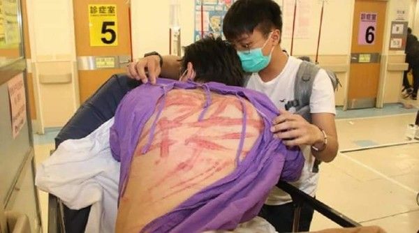 白衣人攻擊元朗市民　血腥照殘忍曝光