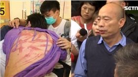 反送中受傷,韓國瑜,組合圖