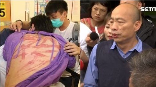 反送中群眾遭毆打　韓國瑜：譴責暴力