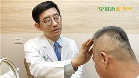 醫師提醒掉髮超過正常數量應及早就醫治療以遠離禿頭困擾