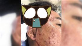 泰國,駕駛,鑰匙,太陽穴,機車,摩托車,爭吵,道歉,刺入,送貨,Rider Gossip 圖／翻攝自Rider Gossip臉書