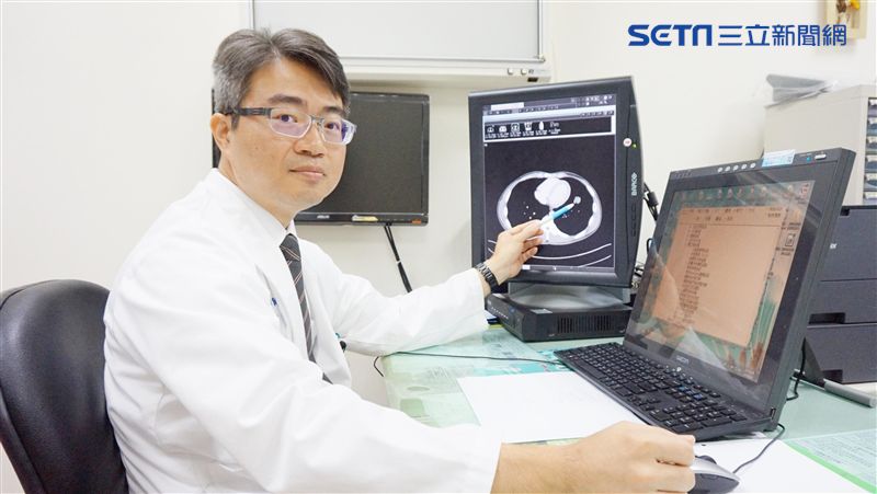 初期肺癌拖成末期　醫曝這件事害了他