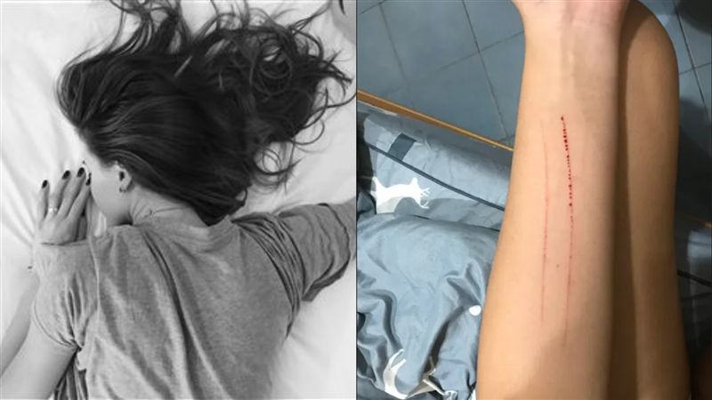 遭鬼壓床！女惡夢驚醒多「2條血痕」
