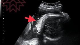 婦產科醫師蘇怡寧臉書