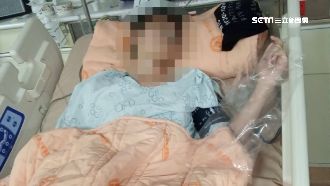 少年騎單車遭犬追！慘摔飛急開刀搶救