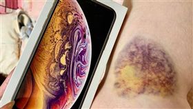 瘀青太時尚了！一名黃姓女網友表示，他日前出門不小心車禍摔傷，結果腿部出現一塊瘀青，特別的是，她的瘀青與iPhone的「木星背景」神似，看上去頗有時尚感。照片曝光後，掀起網友熱議，紛紛直喊：「笑慘了，妳傷的好時尚！」（圖／翻攝自爆廢公社）