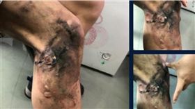 中國大陸,小米手機,爆炸,售後服務,燒傷（微博）