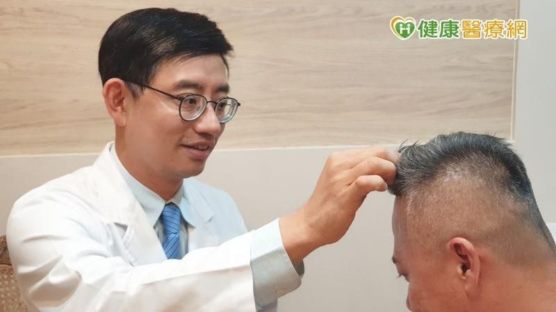 藝術植髮　打造熟男美形好感度