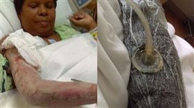 美國,食肉菌,樂園,感染,水池,刮傷,壞死,細胞,手術,醫療費, 圖／翻攝自推特