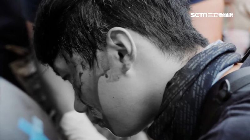 元朗再度見血！港警子彈打中一男頭部