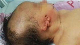 嬰兒「耳朵一串」畸形　父接下愣5分鐘：我不要（圖／翻攝自紅星新聞）