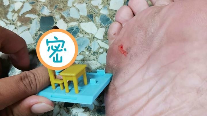 腳底刺出血…尖頭兇手鄙視狂瞪網笑歪