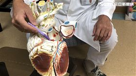 光田綜合醫院,心臟血管外科,郭達智,心肌梗塞,吃到飽,三高