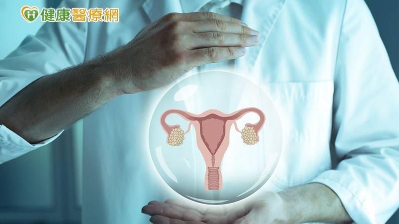 子宮肌瘤治療新趨勢　微創手術不留疤