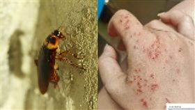  吃藥睡死！她「手被蟑螂咬」慘狀曝光 
pixabay、臉書「爆廢公社二館」