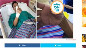 馬來西亞,手機,保護貼,手術,感染,手指,螢幕保護貼
https://www.worldofbuzz.com/young-mans-thumb-got-swollen-infected-after-he-unknowingly-cut-it-on-cracked-screen-protector/?fbclid=IwAR1dVmXTwBwSjWtEUUSq1Rv8IUCkHQDVprLrtDAg8