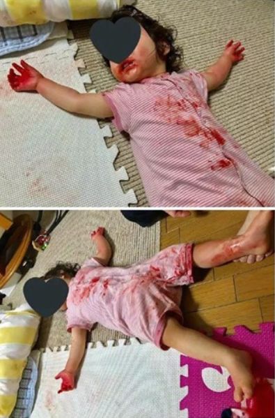 女兒 滿身血 倒地 媽回家一看崩潰嚇暈超鬧結局網笑瘋 生活 三立新聞網setn Com