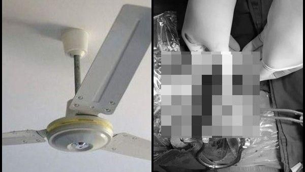 3歲童玩飛高高！頭皮慘遭吊扇削掉