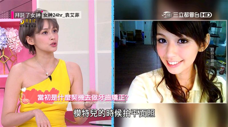 9年矯正生涯　袁艾菲美齒之路大告白