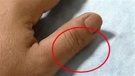 切豬肉拇指劃1公分傷口！竟害他耳聾暈倒險死（圖／翻攝自看看新聞）